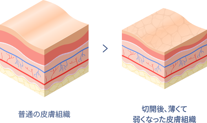 ユエンミクリニック, ユエンミ医院, 韓国美容, 韓国皮膚科, 韓国美容皮膚科値段, 渡韓整形, 美容, 江南皮膚科, 韓国, 手術, 施術, 非手術, ビフォアフター, 糸リフト, 糸リフト持続期間, インモード, シュリンク, リジュラン, フィラー, ヒアルロン酸, レナフィル, ジュビダム, ウルセラ, 矯正, 童顔, 輪郭成形, 輪郭手術,カーバン, カーバンリフト, ジャンバー, ジャンバーリフト, ミントリフト, ワンダーリフト, シルエットソフト, 目の形矯正リフト, 目尻リフト, ほうれい線リフト, ほうれい線フィーラー, 目の下のシワリフト, 目の下のくぼみリフト, 顎ラインリフト, ミント糸, エピティコン, 挙上リフト, 額挙上, 弾力, ツリ目, 目尻, 矯正, 眉, 眉間, 小じわ, 目尻のしわ, アンチエイジング, 小じわ, 中顔面, 中顔面長さ平均, 中顔面長さ理想, 中顔面短い, 中顔面短くする, 小顔, たるみ改善, フェイスライン, 卵型, Vライン, 中顔面縮小リフト, 額挙上リフト, 二重カップル手術, 眼瞼下垂, 眼瞼下垂手術, 美顔型ケア, 額挙上ダウンタイム, 額挙上読み方