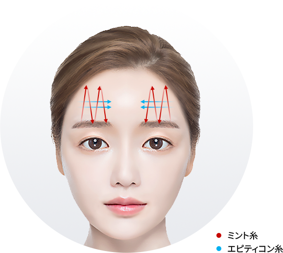 ユエンミクリニック, ユエンミ医院, 韓国美容, 韓国皮膚科, 韓国美容皮膚科値段, 渡韓整形, 美容, 江南皮膚科, 韓国, 手術, 施術, 非手術, ビフォアフター, 糸リフト, 糸リフト持続期間, インモード, シュリンク, リジュラン, フィラー, ヒアルロン酸, レナフィル, ジュビダム, ウルセラ, 矯正, 童顔, 輪郭成形, 輪郭手術,カーバン, カーバンリフト, ジャンバー, ジャンバーリフト, ミントリフト, ワンダーリフト, シルエットソフト, 目の形矯正リフト, 目尻リフト, ほうれい線リフト, ほうれい線フィーラー, 目の下のシワリフト, 目の下のくぼみリフト, 顎ラインリフト, ミント糸, エピティコン, 挙上リフト, 額挙上, 弾力, ツリ目, 目尻, 矯正, 眉, 眉間, 小じわ, 目尻のしわ, アンチエイジング, 小じわ, 中顔面, 中顔面長さ平均, 中顔面長さ理想, 中顔面短い, 中顔面短くする, 小顔, たるみ改善, フェイスライン, 卵型, Vライン, 中顔面縮小リフト, 額挙上リフト, 二重カップル手術, 眼瞼下垂, 眼瞼下垂手術, 美顔型ケア, 額挙上ダウンタイム, 額挙上読み方