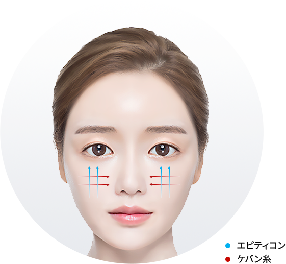 ユエンミクリニック, ユエンミ医院, 韓国美容, 韓国皮膚科, 韓国美容皮膚科値段, 渡韓整形, 美容, 江南皮膚科, 韓国, 手術, 施術, 非手術, ビフォアフター, 糸リフト, 糸リフト持続期間, インモード, シュリンク, リジュラン, フィラー, ヒアルロン酸, レナフィル, ジュビダム, ウルセラ, 矯正, 童顔, 輪郭成形, 輪郭手術,カーバン, カーバンリフト, ジャンバー, ジャンバーリフト, ミントリフト, ワンダーリフト, シルエットソフト, 目の形矯正リフト, 目尻リフト, ほうれい線リフト, ほうれい線フィーラー, 目の下のシワリフト, 目の下のくぼみリフト, 顎ラインリフト, ミント糸, エピティコン, 挙上リフト, 額挙上, 弾力, ツリ目, 目尻, 矯正, 眉, 眉間, 小じわ, 目尻のしわ, アンチエイジング, 小じわ, 中顔面, 中顔面長さ平均, 中顔面長さ理想, 中顔面短い, 中顔面短くする, 小顔, たるみ改善, フェイスライン, 卵型, Vライン, 中顔面縮小リフト, 額挙上リフト, 二重カップル手術, 眼瞼下垂, 眼瞼下垂手術, 美顔型ケア, 額挙上ダウンタイム, 額挙上読み方