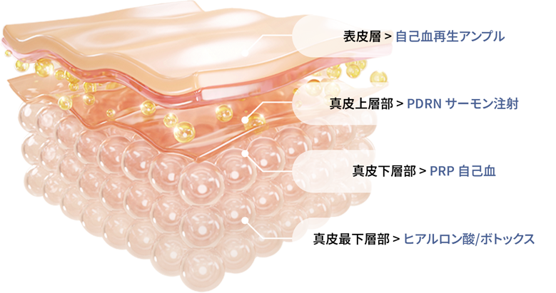 ユエンミクリニック, ユエンミ医院, 韓国美容, 韓国皮膚科, 韓国美容皮膚科値段, 渡韓整形, 美容, 江南皮膚科, 韓国, 手術, 施術, 非手術, ビフォアフター, 糸リフト, 糸リフト持続期間, インモード, シュリンク, リジュラン, フィラー, ヒアルロン酸, レナフィル, ジュビダム, ウルセラ, 矯正, 童顔, 輪郭成形, 輪郭手術,唇フィラー, 韓国ヒアルロン酸上手い, スキンボトックス, 脂肪移植, かわいい, レナフィル, レスチレン, ジュビダム, ベロテロ, 自己血, サーモン注射, ボトックス, 自体開発, 鼻の整形, 口角ボトックス, 顔脂肪吸引, 顔脂肪移植, 唇の形, イマピラー, ほうれい線, ほうれい線フィラー, Vライン, ダークサークル, 韓国フィラー, 韓国ボトックス, 童顔整形, 童顔施術, 小さな唇, 非対称矯正, 四角顎, 人中縮小, 人中縮小ボトックス, 高い鼻, ハイコ, 鼻先, 鼻根, 小鼻, 鼻背, 丸い鼻, 鷲鼻, 涙袋フィーラー, 鼻フィーラー