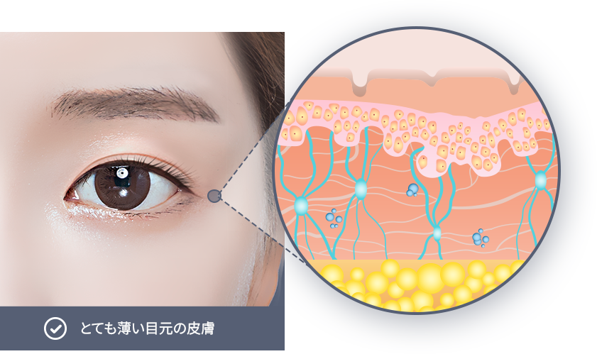 유앤미의원,유앤미클리닉,유앤미,강남유앤미,신논현유앤미,논현유앤미,서울유앤미클리닉,서울피부과,서울클리닉,한국피부과,눈꼬리리프팅,눈매교정잘하는곳,강남눈매교정,강남쌍커플수술,쌍커플수술잘하는곳,안검하수교정,눈밑지방재배치,눈매교정가격,강남얼굴리프팅,강남실리프팅잘하는곳,실리프팅