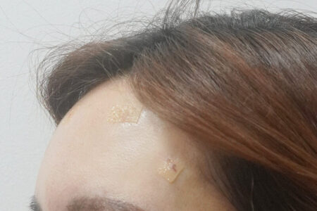 額フィラー (ベベフィル)